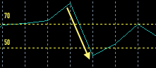 0_1515289054488_Double cross.png